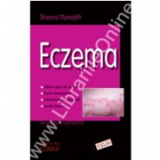 Eczema