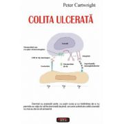 Colita ulcerata