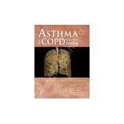 Asthma and COPD Basic Mechanisms and Clinical Management