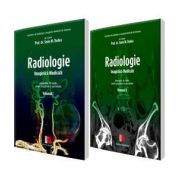 Sorin Marian Dudea - Radiologie, Imagistica medicala. Indrumator de studiu pentru pregatirea in specialitate. Volumele I si II