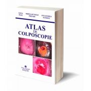 Atlas de Colonoscopie