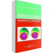 Keratoconus. Diagnostic si tratament - Catalina Corbu