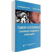 Tumori duodenale. Consideratii imagistice si endoscopice