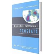 Diagnosticul cancerului de prostata