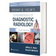 Brant and Helm s Fundamentals of Diagnostic Radiology: Print + eBook with Multimedia