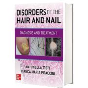 Disorders of the Hair and Nail: Diagnosis and Treatment