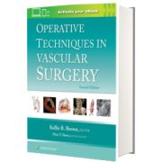 Operative Techniques in Vascular Surgery