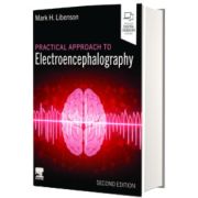 Practical Approach to Electroencephalography