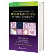 Rosen s Diagnosis of Breast Pathology by Needle Core Biopsy