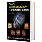 Timor s Ultrasonography of the Prenatal Brain