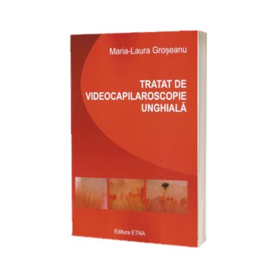 Tratat de videocapilaroscopie unghiala
